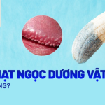 Bị Chuỗi Hạt Ngọc Có Quan Hệ Được Không?