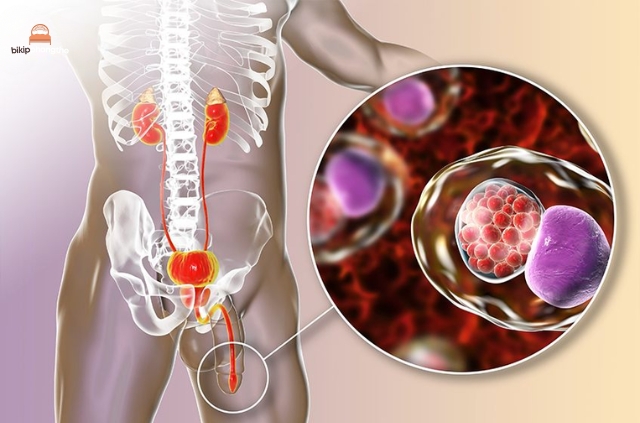 Chlamydia là một bệnh nhiễm trùng nguy hiểm lây truyền qua đường tình dục